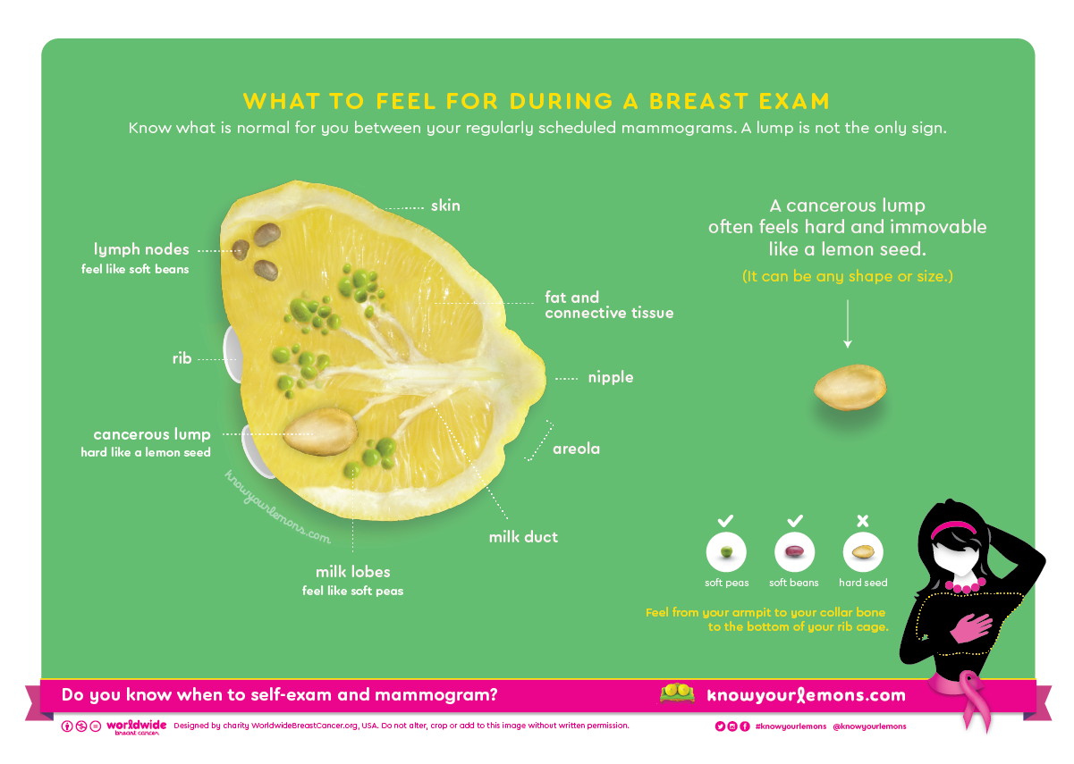 Malignant tumor of breast (disorder), Breast cancer, Malignant tumour of breast, CA - Breast cancer,breast tumor, mammary cancer, mammary tumor, malignant tumor of the breast, mammary neoplasm, primary breast cancer, malignant neoplasm of breast,Malignant tumor of breast,mammary cancer,