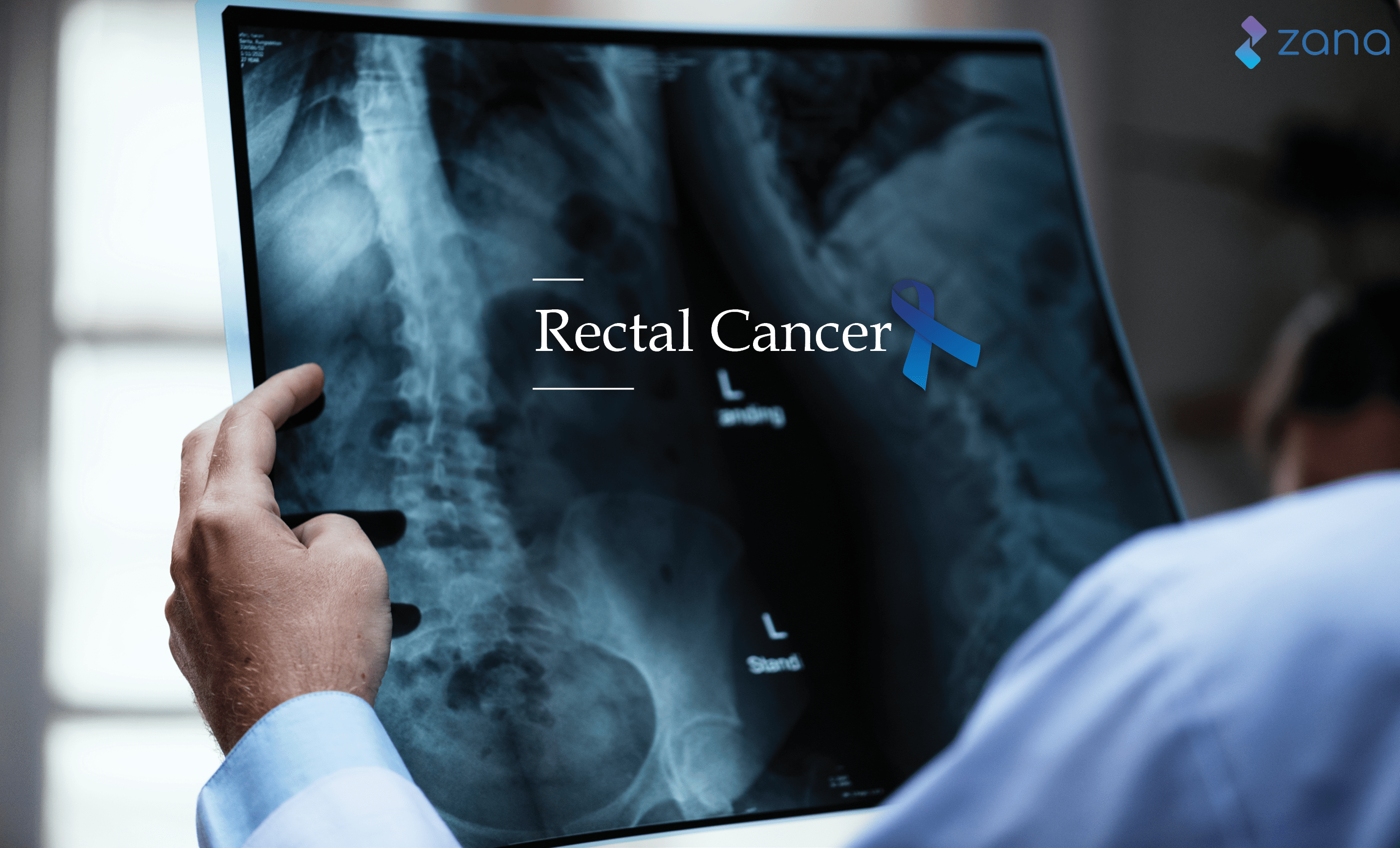 colon-rectal-cancer-colorectal-cancer-treatment-alaska-surgical