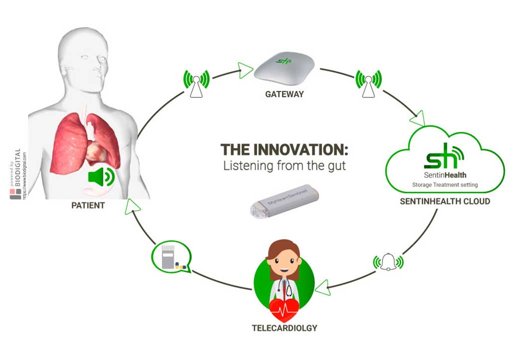We are collaborating with EIT Health, on the RealWorld4Clinic (RW4C) project which focuses on the development of MyHeartSentinel, an implanted medical device that dovetails greater patient data, clinical research and clinical care.