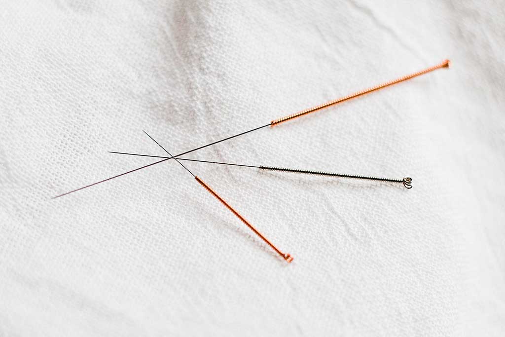 Experts debate whether acupuncture can relieve chronic pain