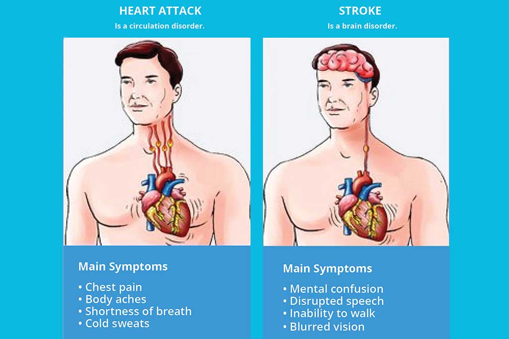 Stroke What Is The Difference Between A Heart Attack And A Stroke